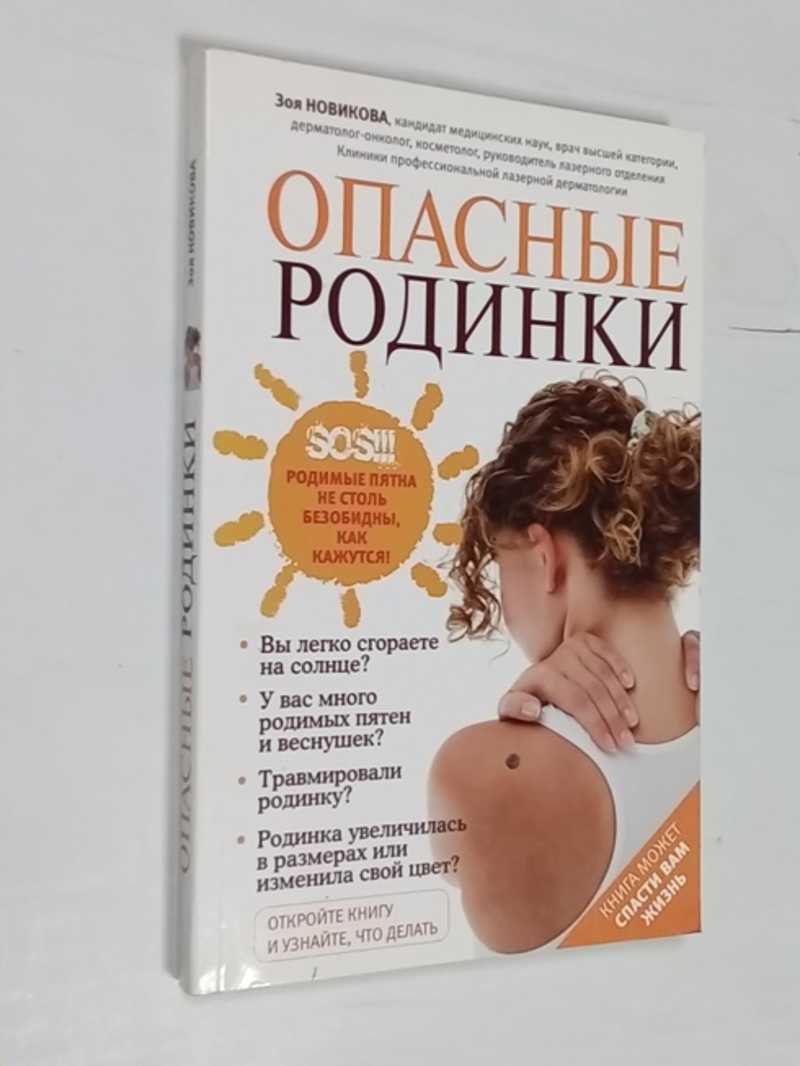Опасные родинки