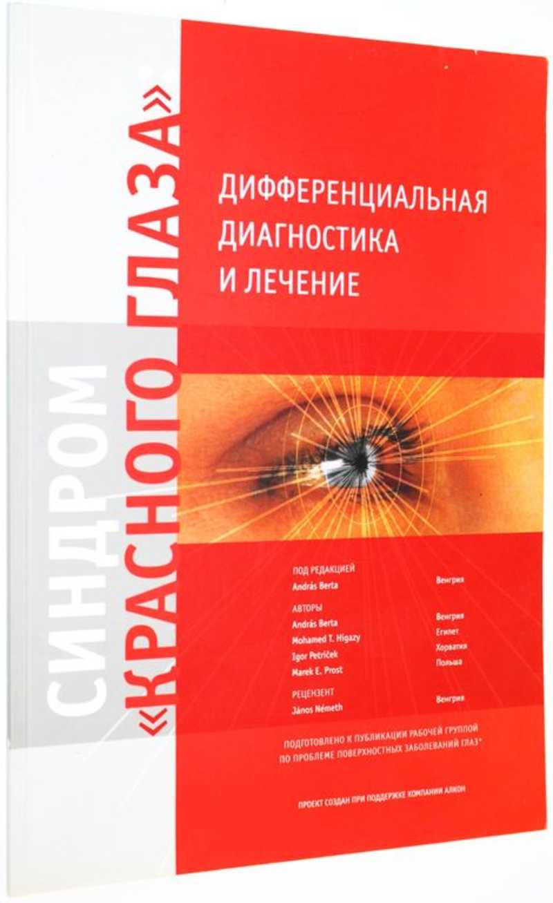 Синдром красного глаза: дифференциальная диагностика и лечение